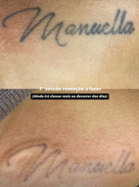 Evolução do caso